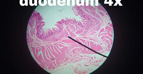 Duodenum Histology