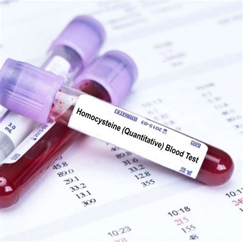 Homocysteine (Quantitative) Blood Test | Blood Tests in London