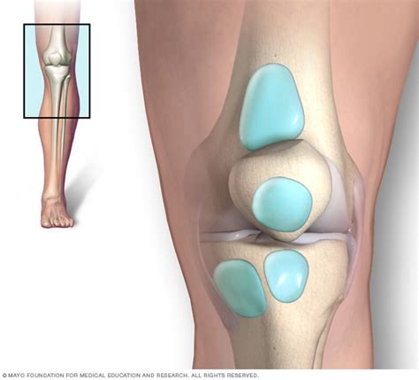 All You Need To Know About Knee Bursitis – Myodetox