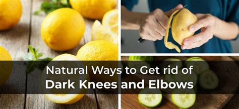 Dark Knees and Elbows: 10 Natural Treatments to Dark, Rough Skin Around ...