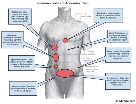 Pin on Sickness Cures/Recipes