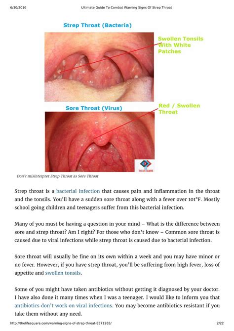 PPT - Ultimate Guide To Combat Warning Signs Of Strep Throat PowerPoint Presentation - ID:7362558