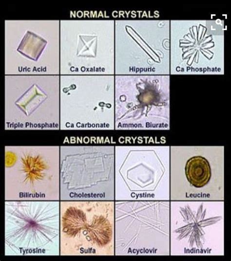 Urine Crystals - MEDizzy