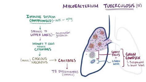 Tuberculosis cases in Rwanda decrease by 41%