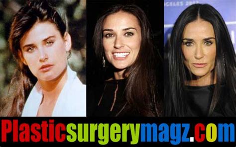 Demi Moore Plastic Surgery Before and After | Plastic Surgery Magazine