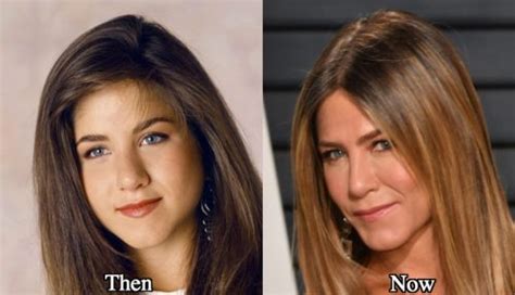 Jennifer Aniston nose job before and after photos - Latest Plastic ...