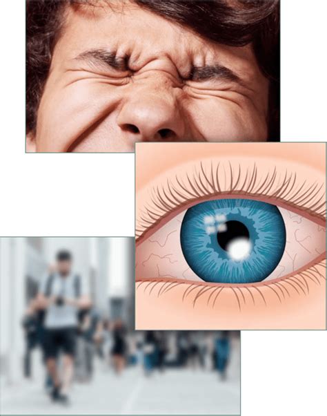 Corneal Infections | NorthEast Ohio Eye Surgeons