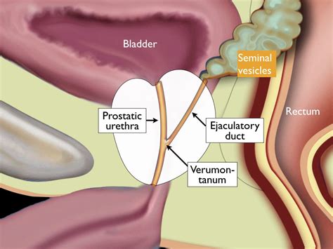 The Radiology Assistant : Prostate Anatomy