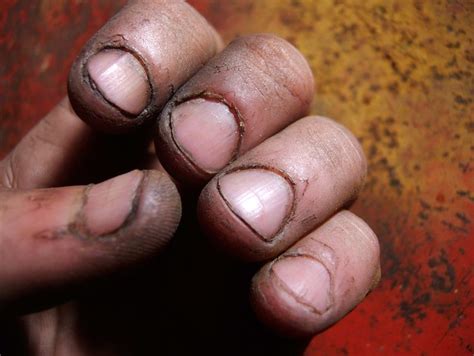 Dirty Fingernails | Flickr - Photo Sharing!