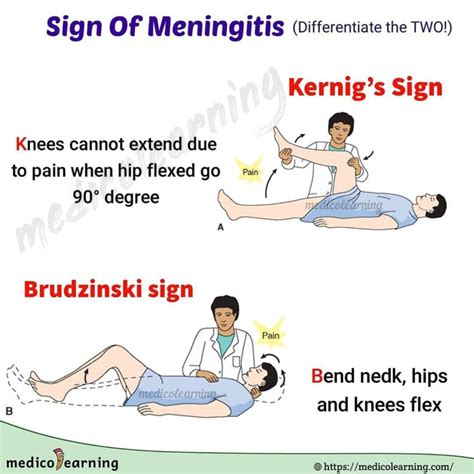 Meningitis – MedicoLearning