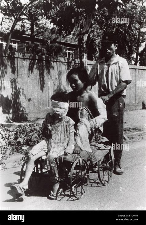 Nagasaki atomic bomb survivors who have received some medical care Stock Photo: 69739595 - Alamy