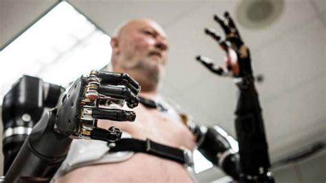 A new 'artificial human arm' will be available in 2023 | NoypiGeeks