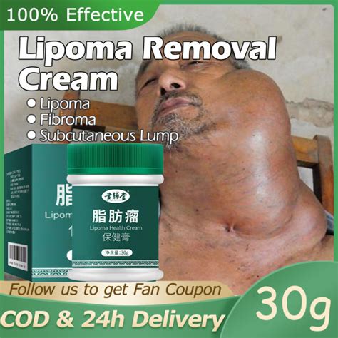 Lipoma Removal Cream Original Bukol Treatment Tumor Skin Swelling ...