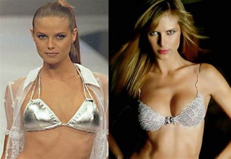 Heidi Klum Plastic Surgery Before And After Photos #plasticsurgery #celebrity #heidi klum # ...