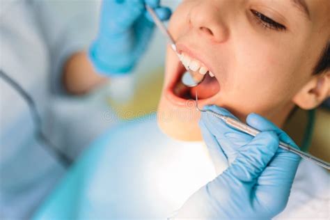 Little Boy with Open Mouth in a Dental Cabinet Stock Photo - Image of clinic, dental: 137052132