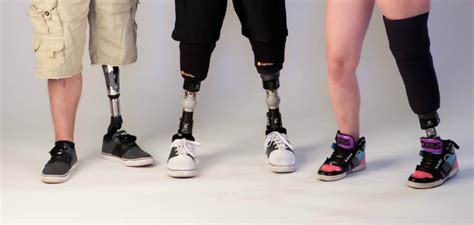 What Is Life Like with a Lower Limb Prosthesis?