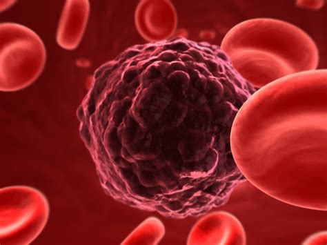 ASH 2020: Chemotherapy-Free Combination Treatment for Chronic Lymphocytic Leukemia Reveals High ...