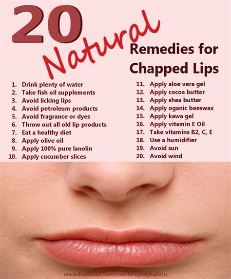 20 Remedies For Chapped Lips💋 - Musely