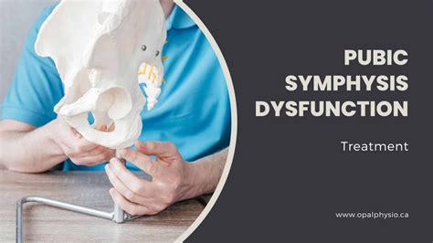 Pubic Symphysis Dysfunction Treatment | Langley, BC