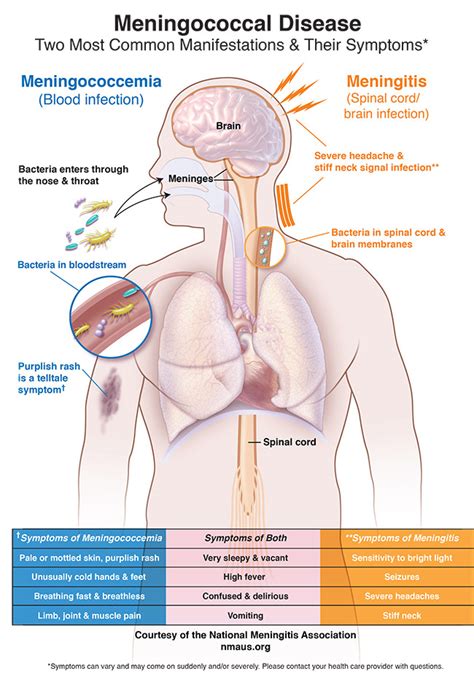 What are the symptoms? – National Meningitis Association