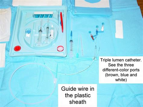 Clinical Notes: Central Line Placement: A Step-by-Step Procedure Guide with Photos