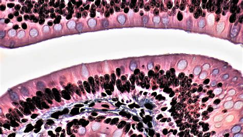 Mammalian Histology: Epithelial Tissues – Berkshire Community College ...