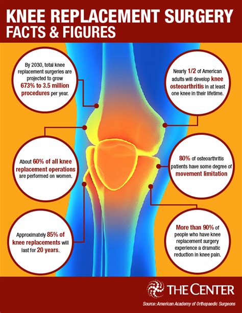 Knee Replacement Surgery By The Numbers | The Center