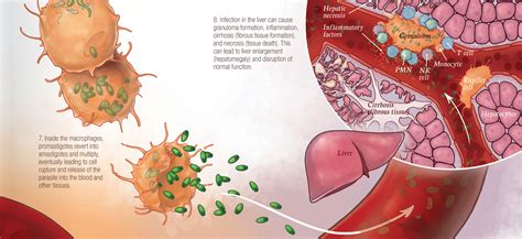 Visceral Leishmaniasis – Inessa Stanishevskaya | Biomedical Communication