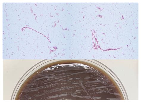 Microbiology Case Study: Bacteremia with Long, Gram Negative Rod in a 34 Year Old Patient ...