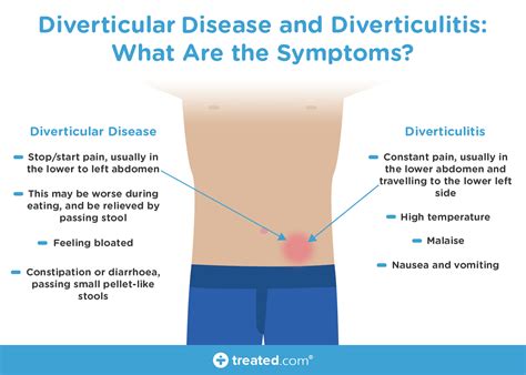 Diverticulitis Signs Symptoms (And Why They Occur)