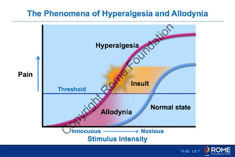 Bowel 033 – The Phenomena of Hyperalgesia and Allodynia – Rome Online