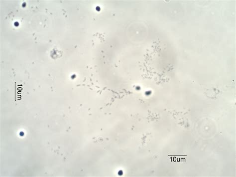 Biofilms in Drinking Water Under the Microscope