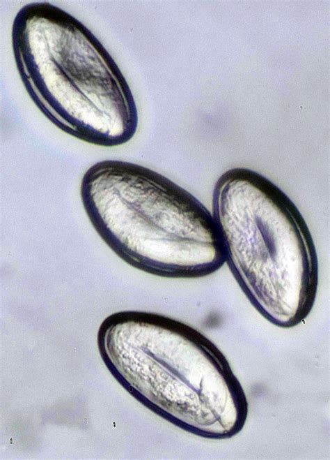 Pinworm Eggs Comparison at 40x