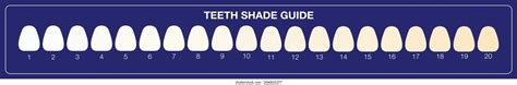 15+ Teeth Color Chart - MohammadIanto