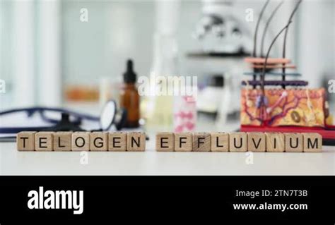 Causes of telogen effluvium and prevention and structure of skin and hair. Scalp disease is ...