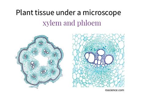 Xylem And Phloem Under Microscope