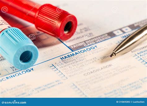 Hematological blood tests stock image. Image of oncology - 31069285