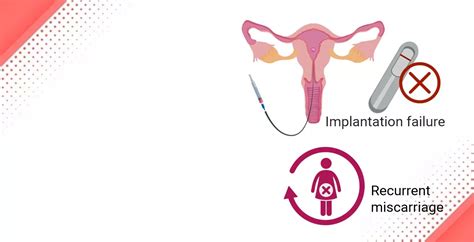 Recurrent Implantation Failure: Symptoms & Treatment | Indira IVF