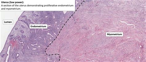 Uterus – Normal Histology – NUS Pathweb :: NUS Pathweb