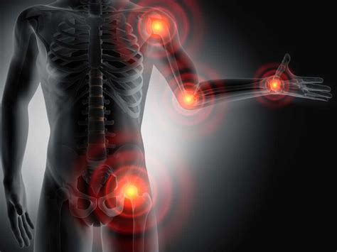 Degenerative Joint Disease: What Is Degenerative Joint Disease?