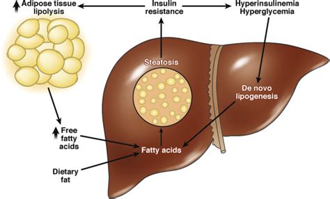 Treating Hepatic Steatosis and Fibrosis by Modulating Mitochondrial ...