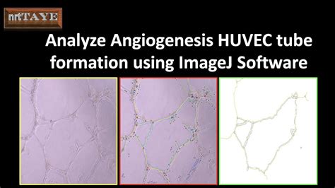 How to analyze Angiogenesis HUVEC cell tube formation assay using ...