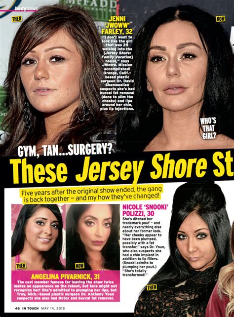 Jersey Shore Cast Plastic Surgery | Neinstein Plastic Surgery