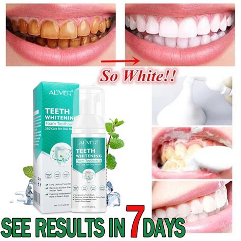 ALIVER Teeth Whitening Mousse Toothpaste Cleansing teeth Mousse Remove ...