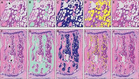 Bone Marrow Histology Slide