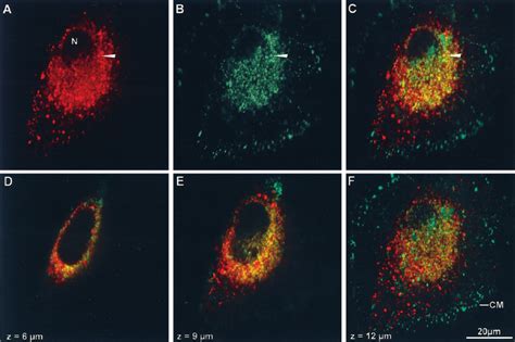 Confocal microscopy images of a G D3 -expressing SK-MEL-28 cell labeled ...