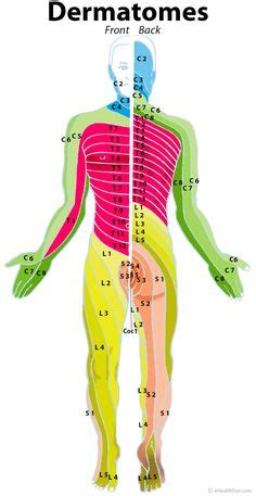 Dermatomes: cervical, lumbar, sacral; herniated disc Occupational Therapy, Disk Herniation ...