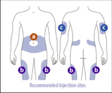 Insulin treatment for Diabetes