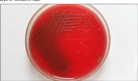 Figure 1 from Hafnia alvei bacteremia following bronchopneumonia in an ...