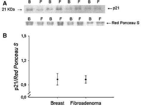 Analysis of protein p21. a Representative autoradiogram with the bands... | Download Scientific ...